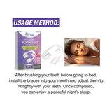 Anti-Grinding & Anti-Snoring Mouthguard – Protective Braces for Teeth