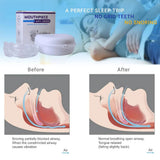 Anti-Snoring Sleep Aid